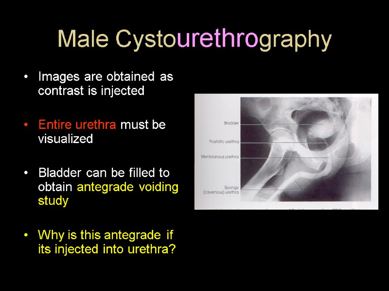 Male Cystourethrography Images are obtained as contrast is injected  Entire urethra must be